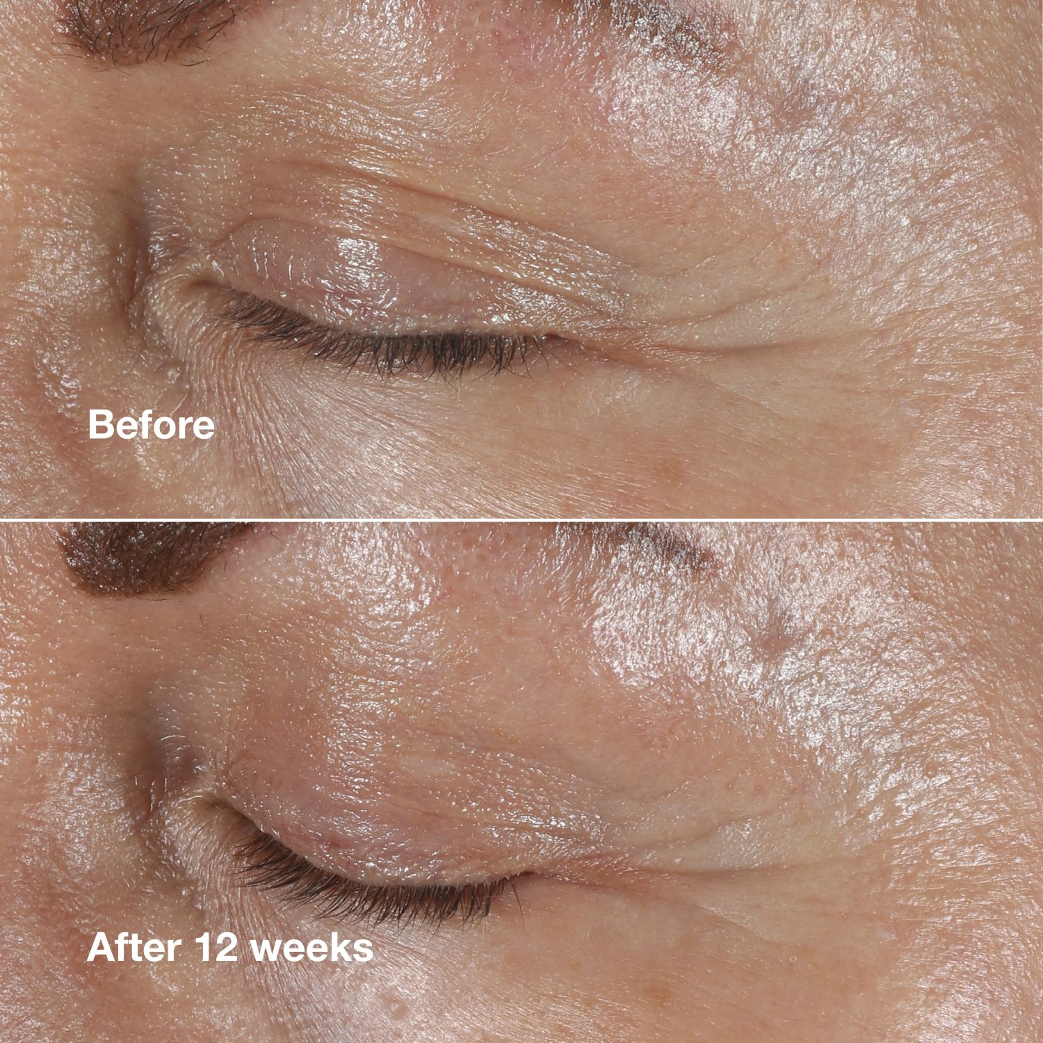 Clinique Smart Clinical Repair Wrinkle Correction Eye Cream