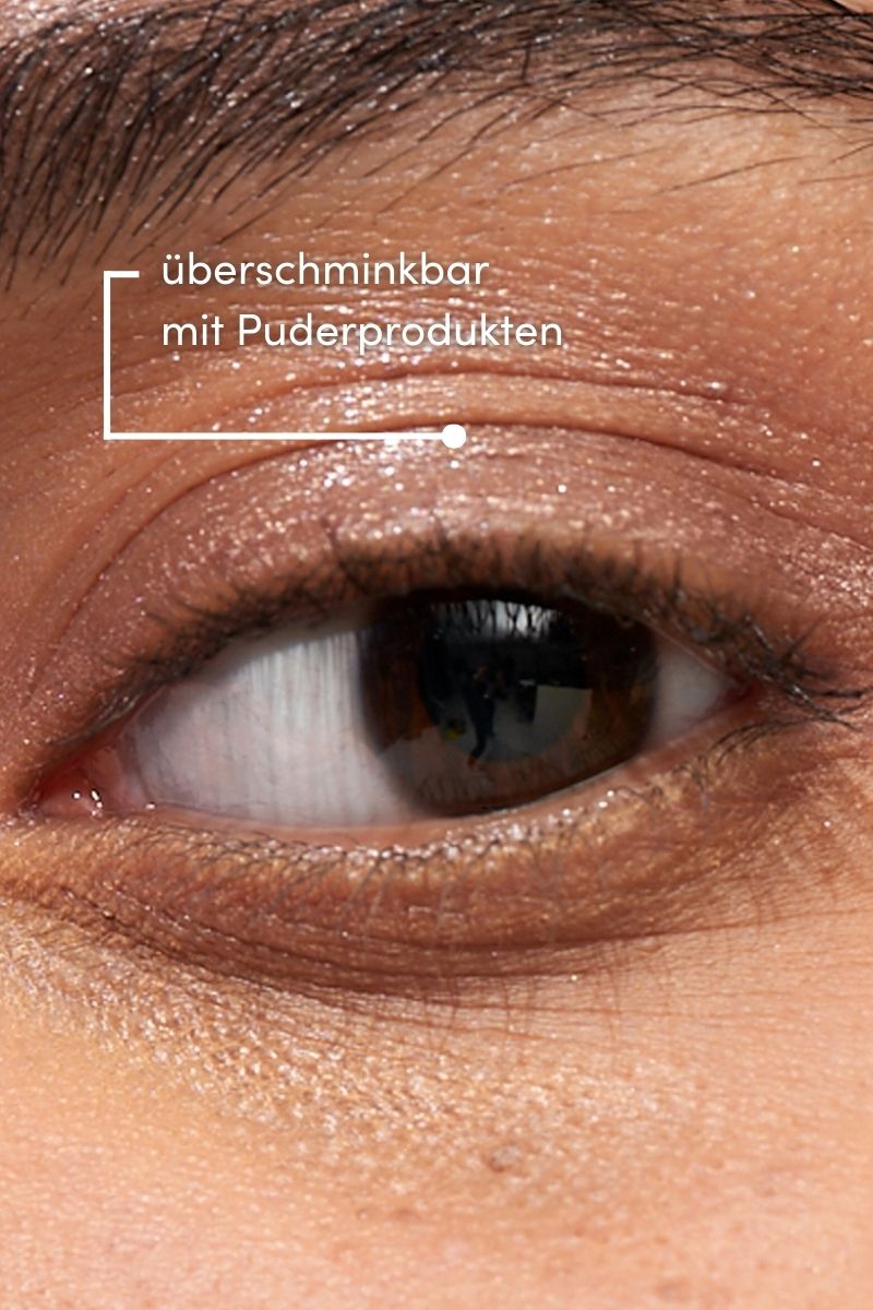 Schlupflider Tapes