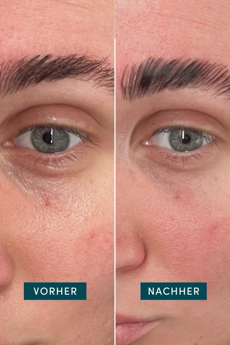 Augenpads mit Vitamin C