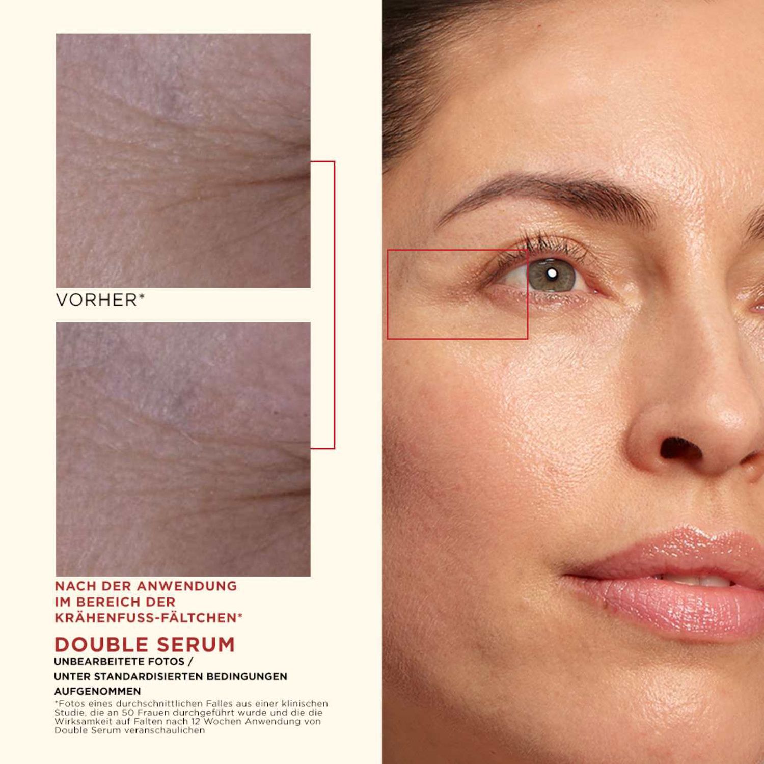 DOUBLE SERUM